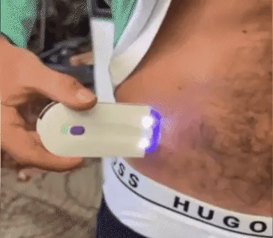 Depiladora Laser Venus™ (Promoción Exclusiva)