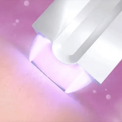 Depiladora Laser Venus™ (Promoción Exclusiva)