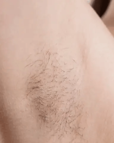 Depiladora Laser Venus™ (Promoción Exclusiva)