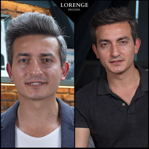 Lorenge — Champú en Barra Anticanas — LLEVA 3 Y PAGA 2 (Promoción Exclusiva)