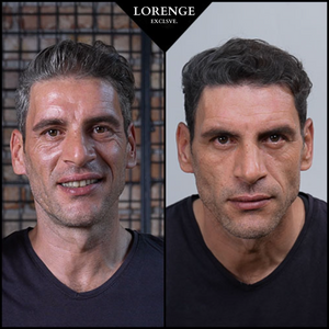 Lorenge — Champú en Barra Anticanas — LLEVA 3 Y PAGA 2 (Promoción Exclusiva)