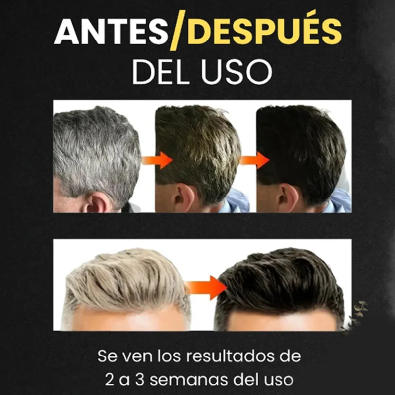 Lorenge — Champú en Barra Anticanas — LLEVA 3 Y PAGA 2 (Promoción Exclusiva)