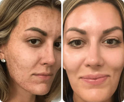 Martha Rodríguez — antes y después
