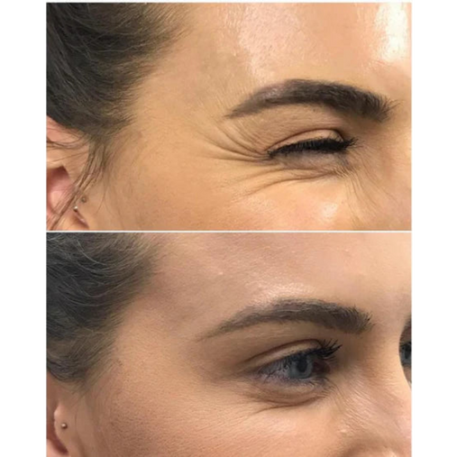Diana Correa — antes y después