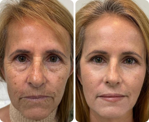 Fabiola Díaz — antes y después