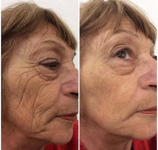 Valeria Sánchez — antes y después