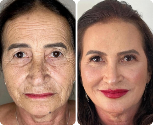 Elena Pérez — antes y después