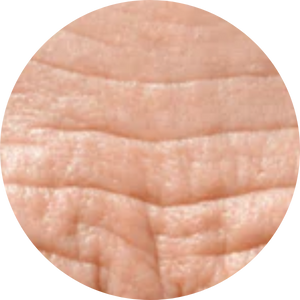 Líneas finas y arrugas