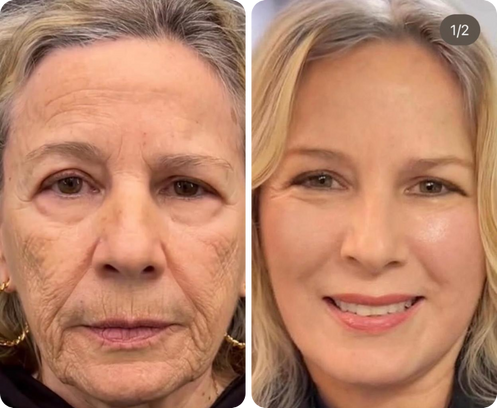 Rosa Morales — antes y después
