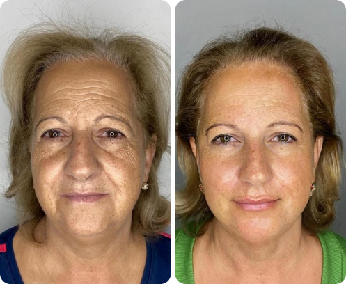 Claudia Ramírez — antes y después