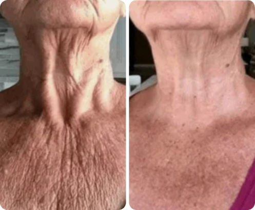 Carla Muñoz — antes y después